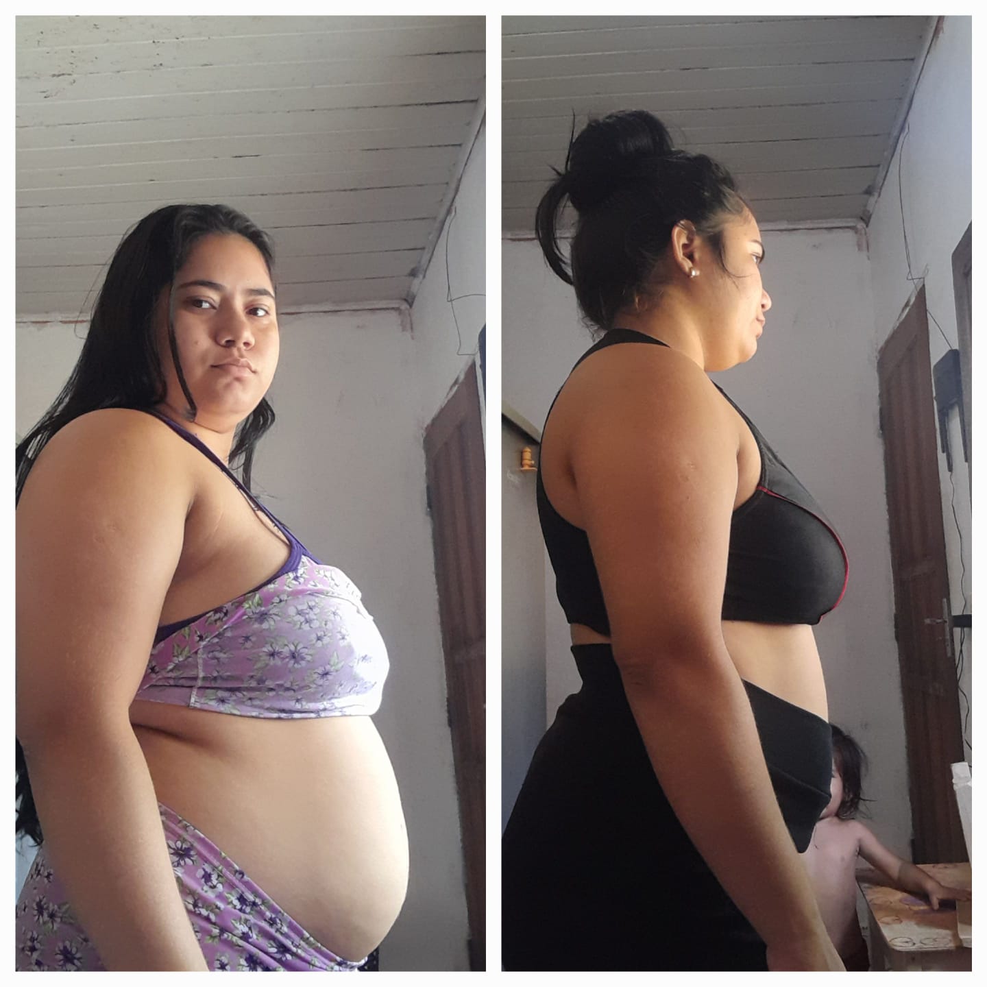 Antes e depois Método CMI